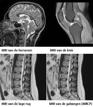 Beelden van een MRI