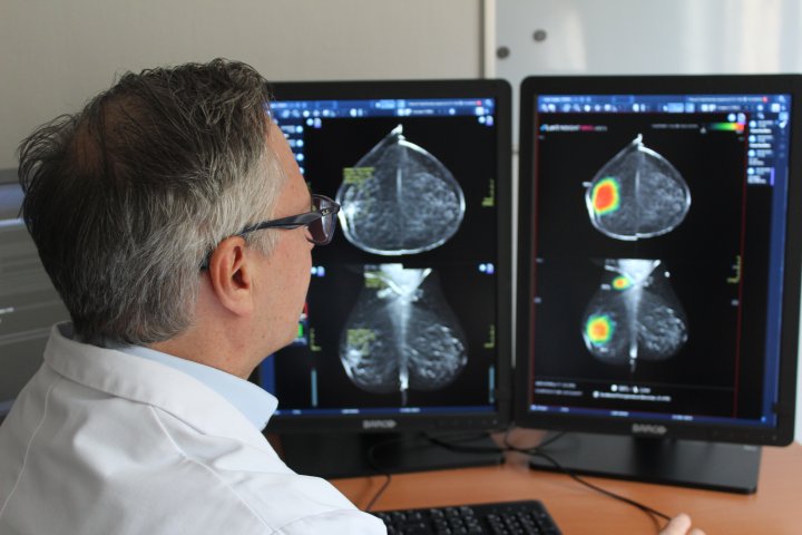 Dr. De Schepper bekijkt een mammografie waar AI-software via een "heat-map" de risicozones weergeeft.