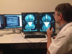 Een arts bekijkt de resultaten van een mammografie